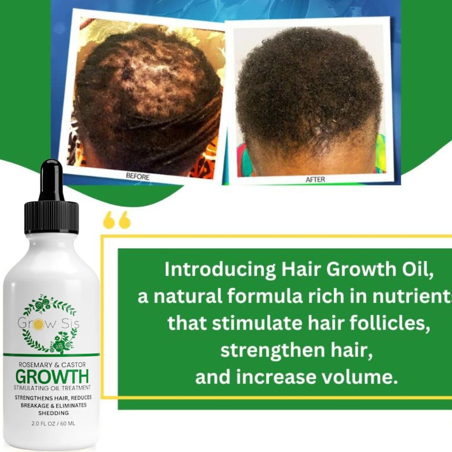 Advance Hair Growth Oil - Natural Growth Serum for Thicker Longer Hair