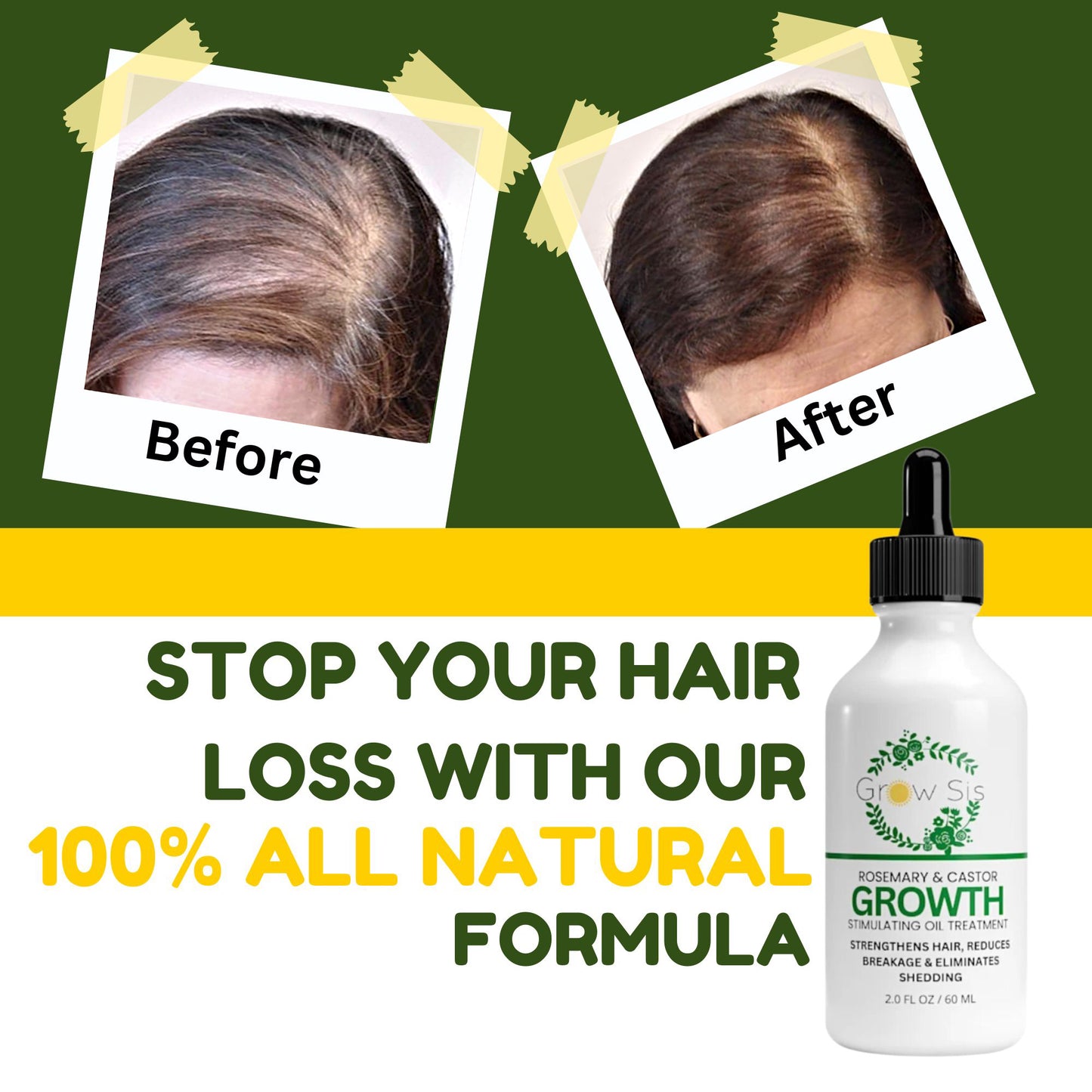 Advance Hair Growth Oil - Natural Growth Serum for Thicker Longer Hair